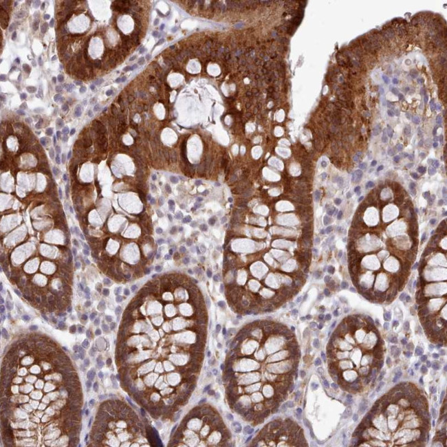 CES3 Antibody in Immunohistochemistry (Paraffin) (IHC (P))