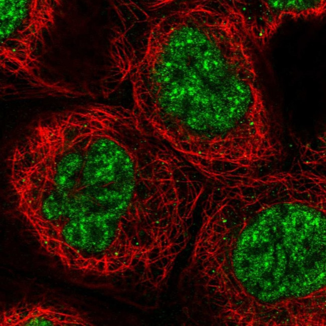 UBE3B Antibody in Immunocytochemistry (ICC/IF)