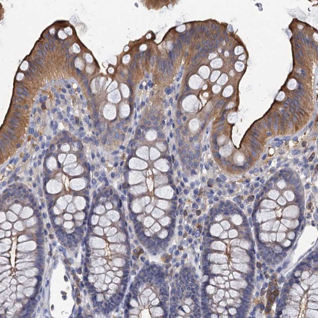 ACSM3 Antibody in Immunohistochemistry (Paraffin) (IHC (P))