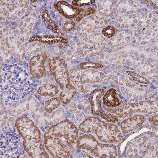 ACSS1 Antibody in Immunohistochemistry (Paraffin) (IHC (P))