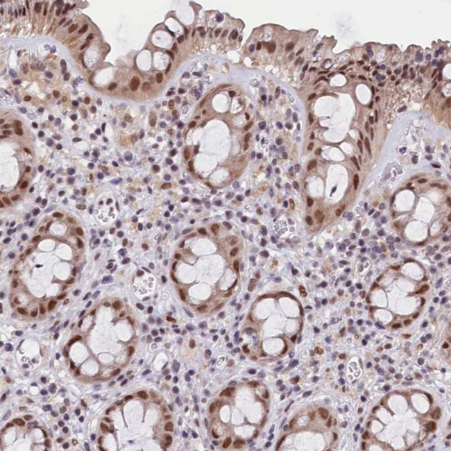 CDYL2 Antibody in Immunohistochemistry (Paraffin) (IHC (P))