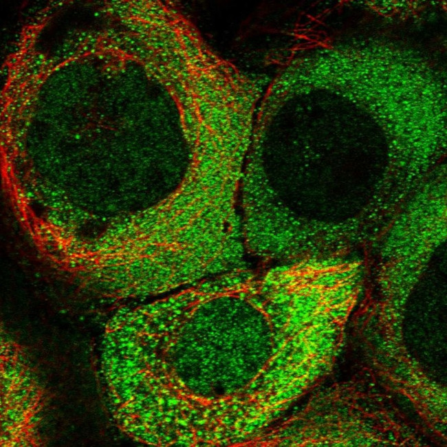 KIAA1609 Antibody in Immunocytochemistry (ICC/IF)