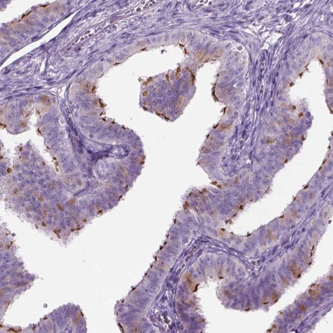 FAM92B Antibody in Immunohistochemistry (Paraffin) (IHC (P))