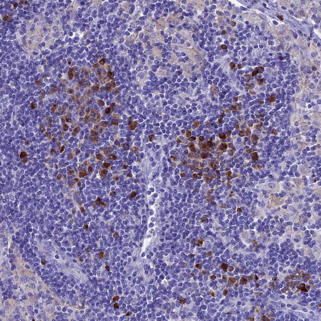 IGSF6 Antibody in Immunohistochemistry (Paraffin) (IHC (P))