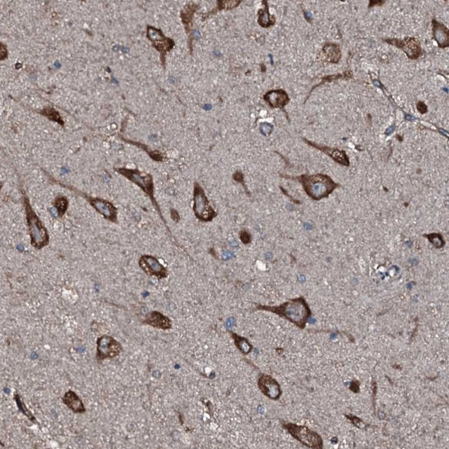 SLC25A38 Antibody in Immunohistochemistry (Paraffin) (IHC (P))