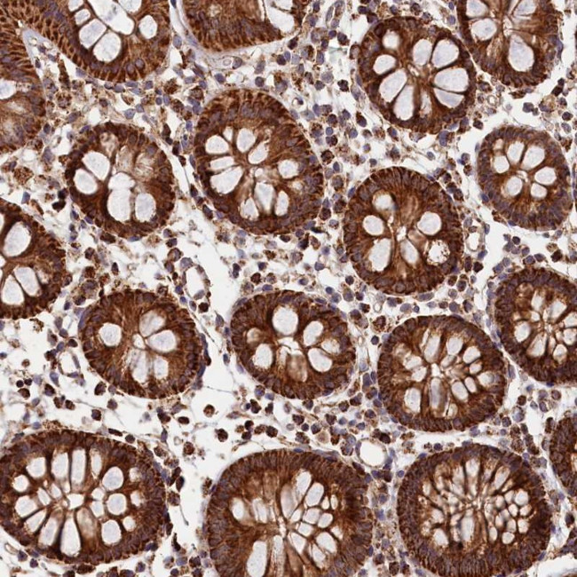 MACROD1 Antibody in Immunohistochemistry (Paraffin) (IHC (P))