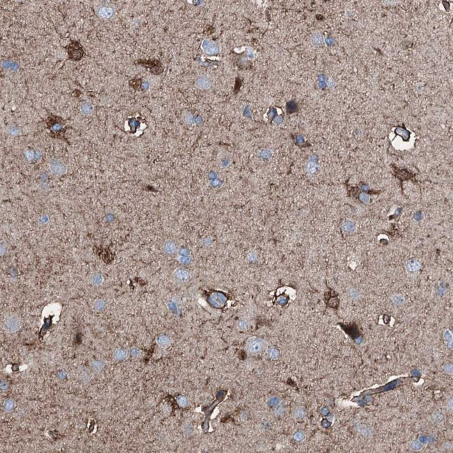 CTRP4 Antibody in Immunohistochemistry (Paraffin) (IHC (P))
