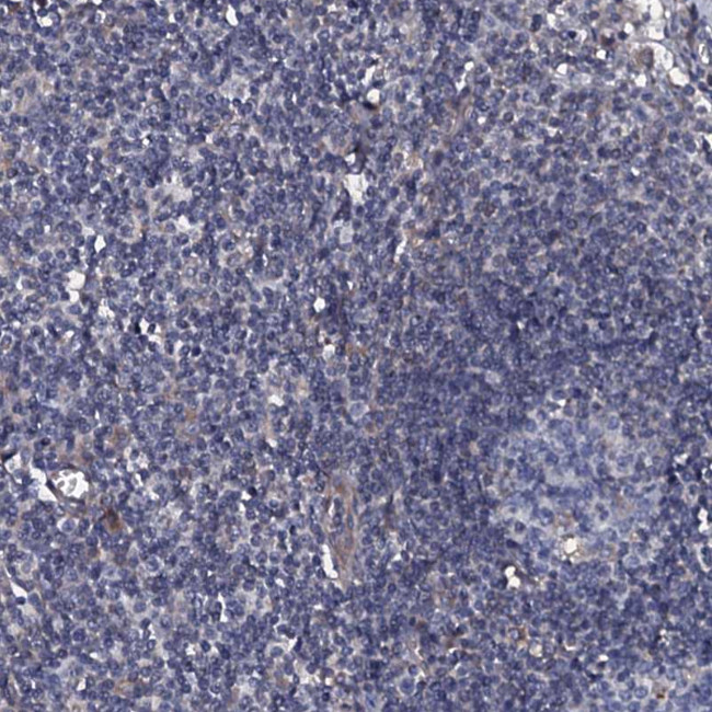 TMEM151A Antibody in Immunohistochemistry (Paraffin) (IHC (P))