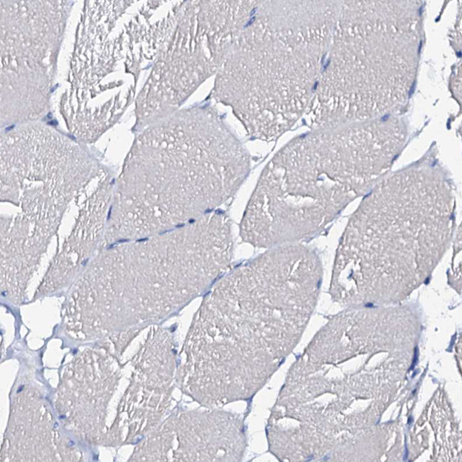Beta-casein Antibody in Immunohistochemistry (Paraffin) (IHC (P))
