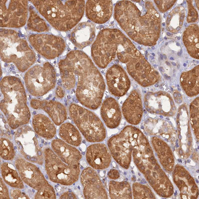 STX12 Antibody in Immunohistochemistry (Paraffin) (IHC (P))