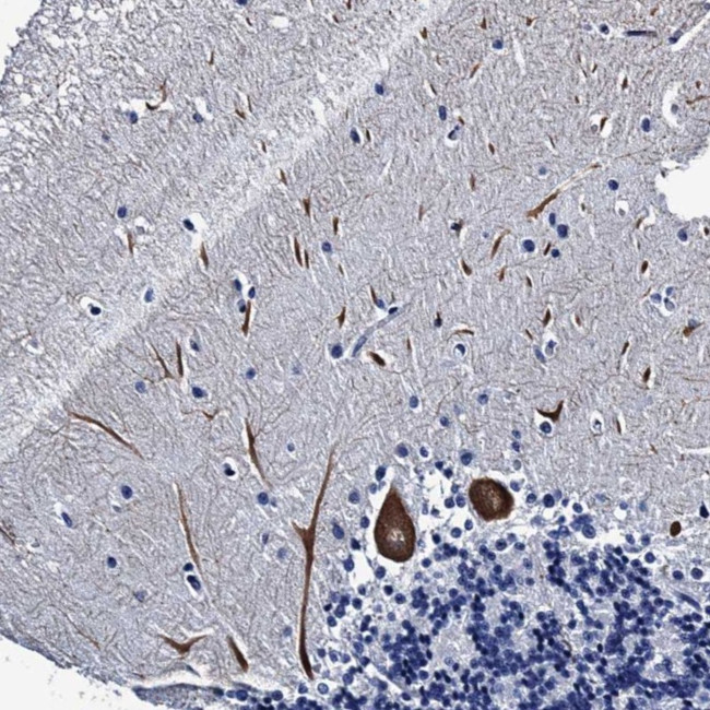 LRRC30 Antibody in Immunohistochemistry (Paraffin) (IHC (P))