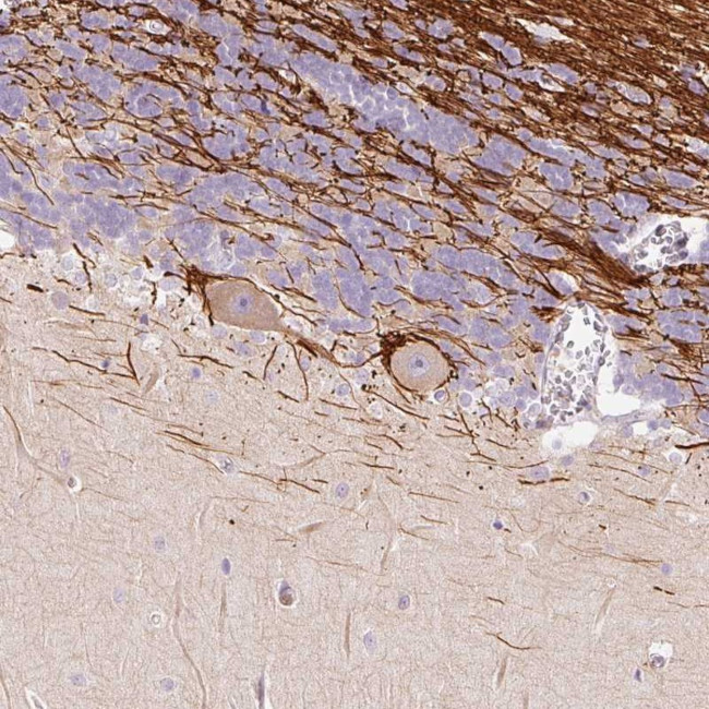 DOK6 Antibody in Immunohistochemistry (Paraffin) (IHC (P))