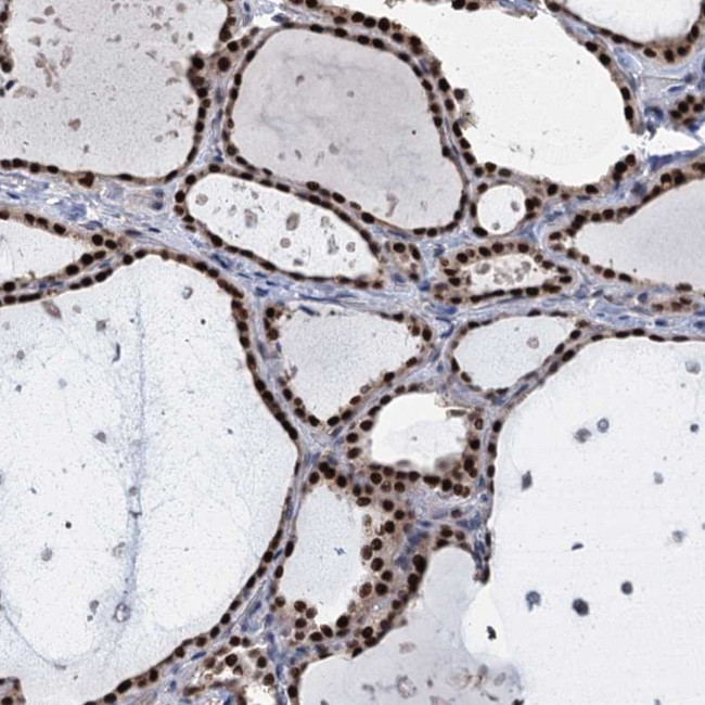 TSEN34 Antibody in Immunohistochemistry (Paraffin) (IHC (P))