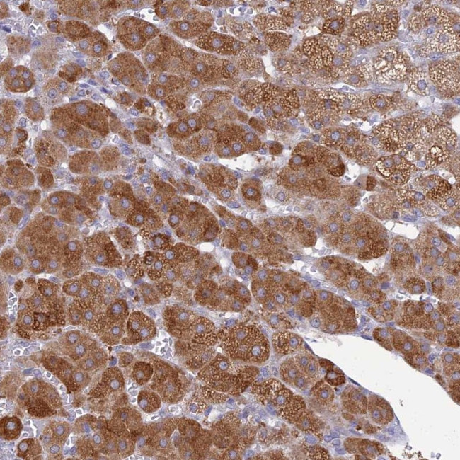 KCTD14 Antibody in Immunohistochemistry (IHC)