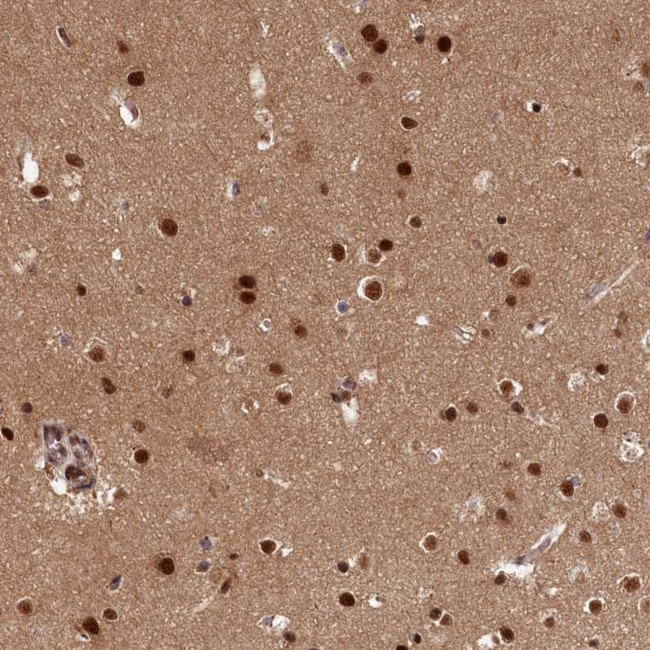 ADIG Antibody in Immunohistochemistry (Paraffin) (IHC (P))