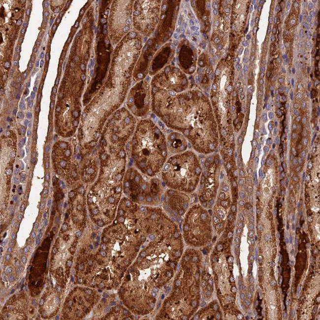 CP070 Antibody in Immunohistochemistry (Paraffin) (IHC (P))