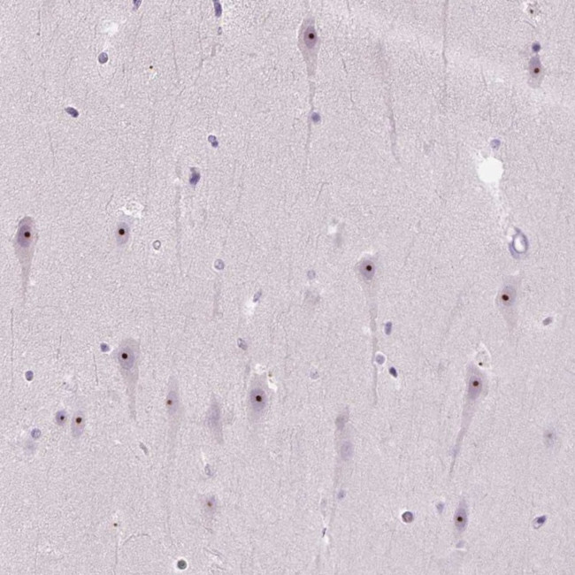 CIRH1A Antibody in Immunohistochemistry (Paraffin) (IHC (P))
