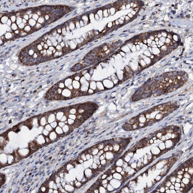 PPP1R3D Antibody in Immunohistochemistry (Paraffin) (IHC (P))