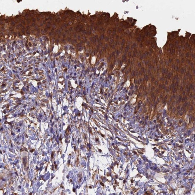 CHMP2A Antibody in Immunohistochemistry (IHC)