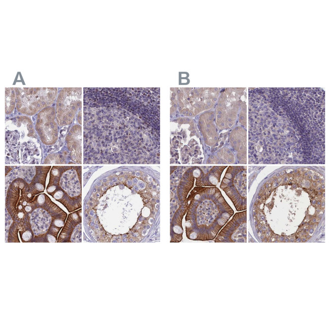 Coronin 2A Antibody in Immunohistochemistry (IHC)
