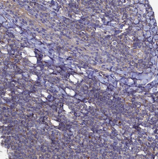 TK2 Antibody in Immunohistochemistry (Paraffin) (IHC (P))