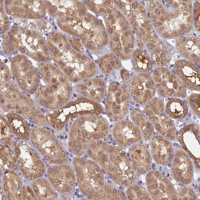 TIMM8B Antibody in Immunohistochemistry (Paraffin) (IHC (P))