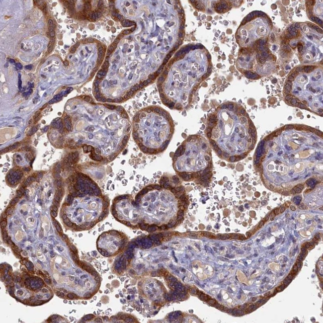DNAJC17 Antibody in Immunohistochemistry (Paraffin) (IHC (P))