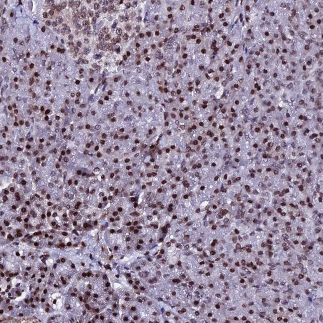 Histone H2A.X Antibody in Immunohistochemistry (IHC)