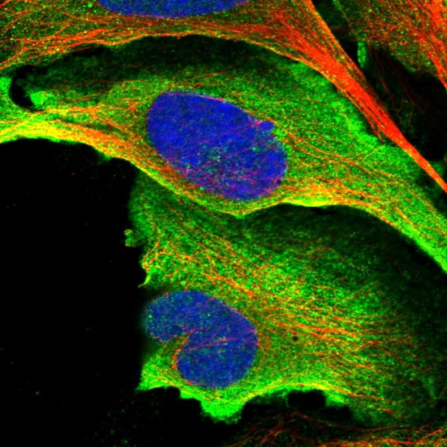 HYLS1 Antibody in Immunocytochemistry (ICC/IF)