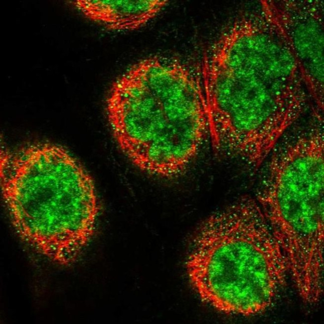 CP070 Antibody in Immunocytochemistry (ICC/IF)