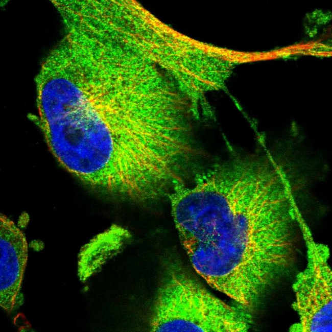 PPP1R13L Antibody in Immunocytochemistry (ICC/IF)