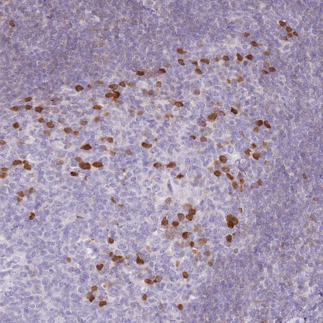 ZBP1 Antibody in Immunohistochemistry (Paraffin) (IHC (P))