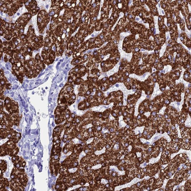 ANKRD29 Antibody in Immunohistochemistry (Paraffin) (IHC (P))