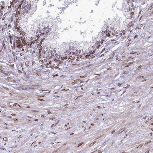 PTCHD4 Antibody in Immunohistochemistry (Paraffin) (IHC (P))