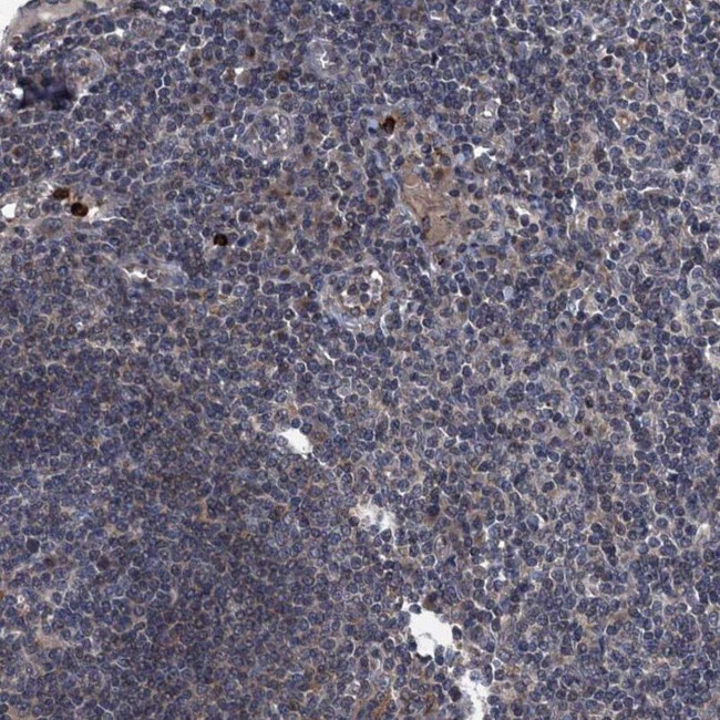 KBTBD8 Antibody in Immunohistochemistry (IHC)