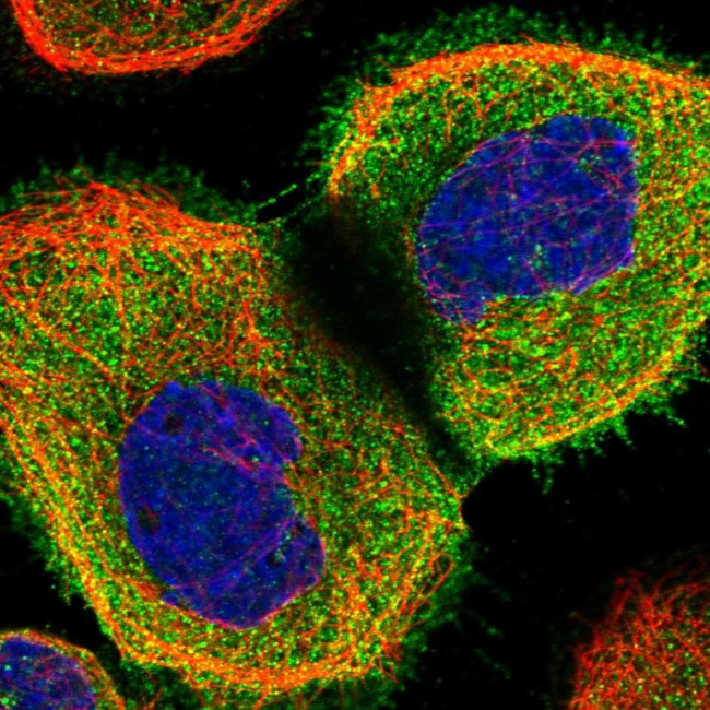 Coronin 2A Antibody in Immunocytochemistry (ICC/IF)