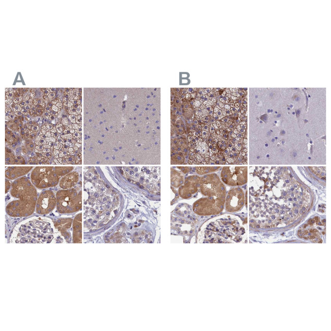 AMDHD2 Antibody in Immunohistochemistry (IHC)