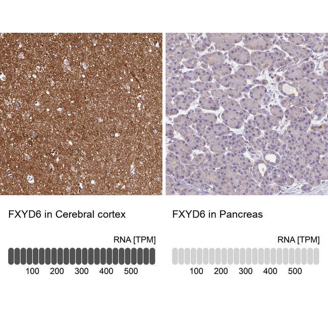FXYD6 Antibody in Immunohistochemistry (Paraffin) (IHC (P))