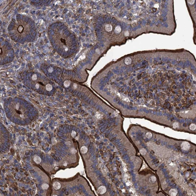 C10orf47 Antibody in Immunohistochemistry (Paraffin) (IHC (P))