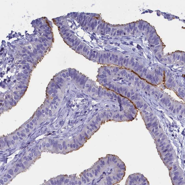 Rotatin Antibody in Immunohistochemistry (Paraffin) (IHC (P))