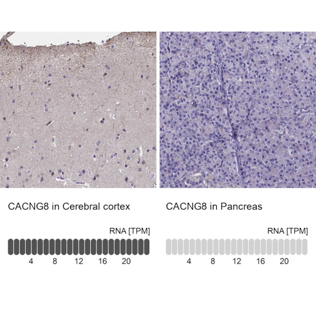 CACNG8 Antibody in Immunohistochemistry (IHC)