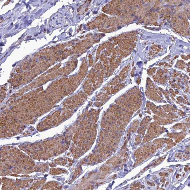 Naked1 Antibody in Immunohistochemistry (Paraffin) (IHC (P))