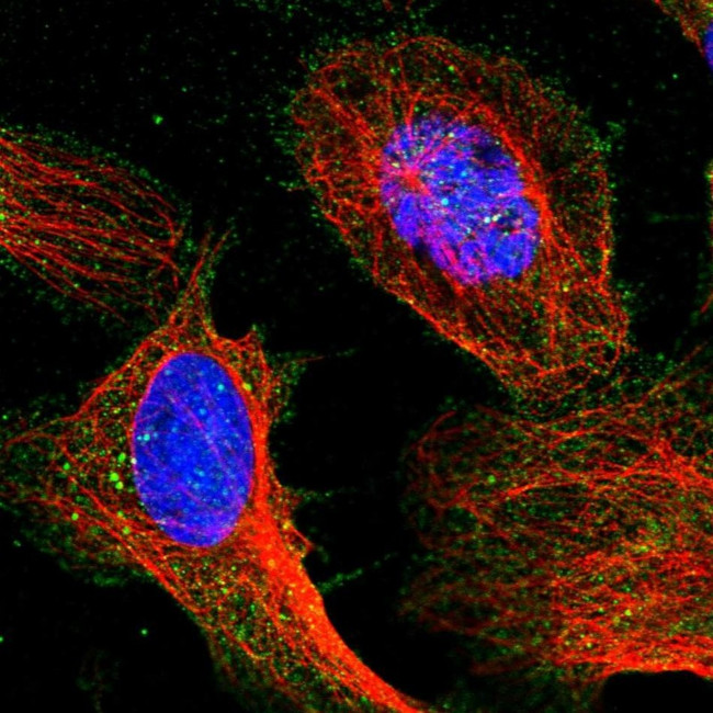 TIGD7 Antibody in Immunocytochemistry (ICC/IF)
