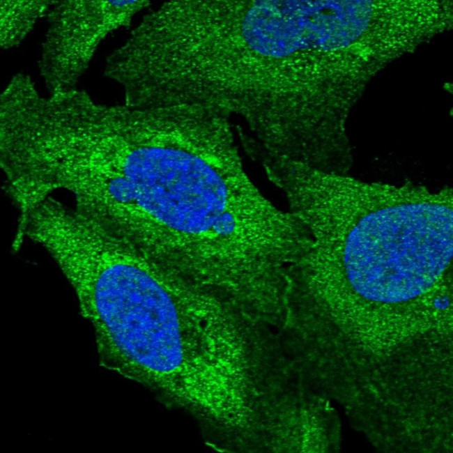ZNF2 Antibody in Immunocytochemistry (ICC/IF)