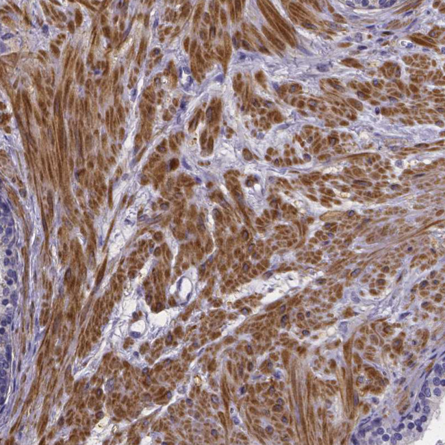 RERG Antibody in Immunohistochemistry (Paraffin) (IHC (P))