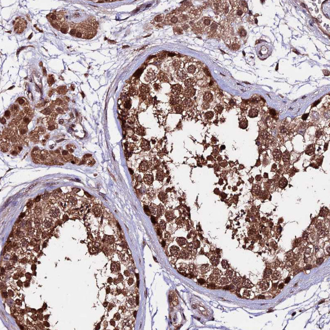 CDKN2AIP Antibody in Immunohistochemistry (Paraffin) (IHC (P))