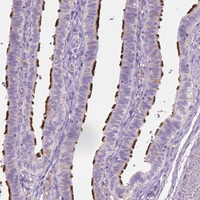 CABCOCO1 Antibody in Immunohistochemistry (Paraffin) (IHC (P))