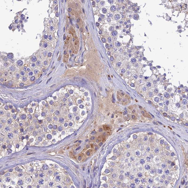 PZP Antibody in Immunohistochemistry (Paraffin) (IHC (P))