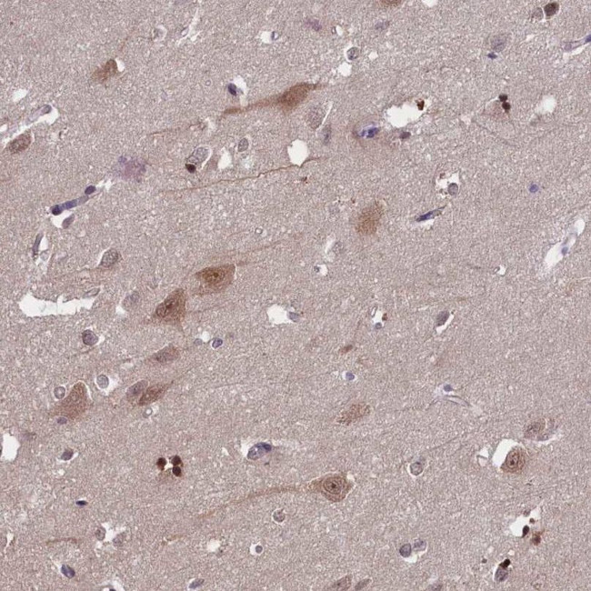 CKAP1 Antibody in Immunohistochemistry (IHC)