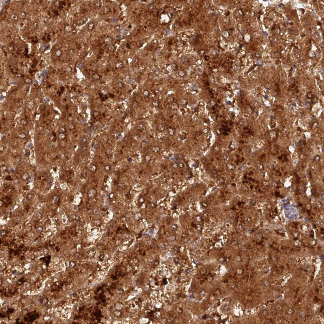 ACSM5 Antibody in Immunohistochemistry (Paraffin) (IHC (P))